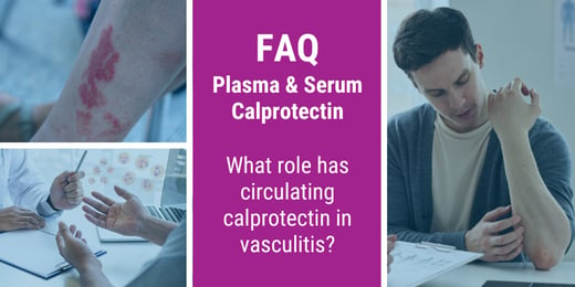 FAQ: What role has circulating calprotectin in vasculitis?