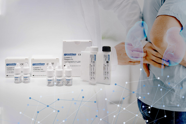 cystatin C immunoassay - open channel, turbidimetric