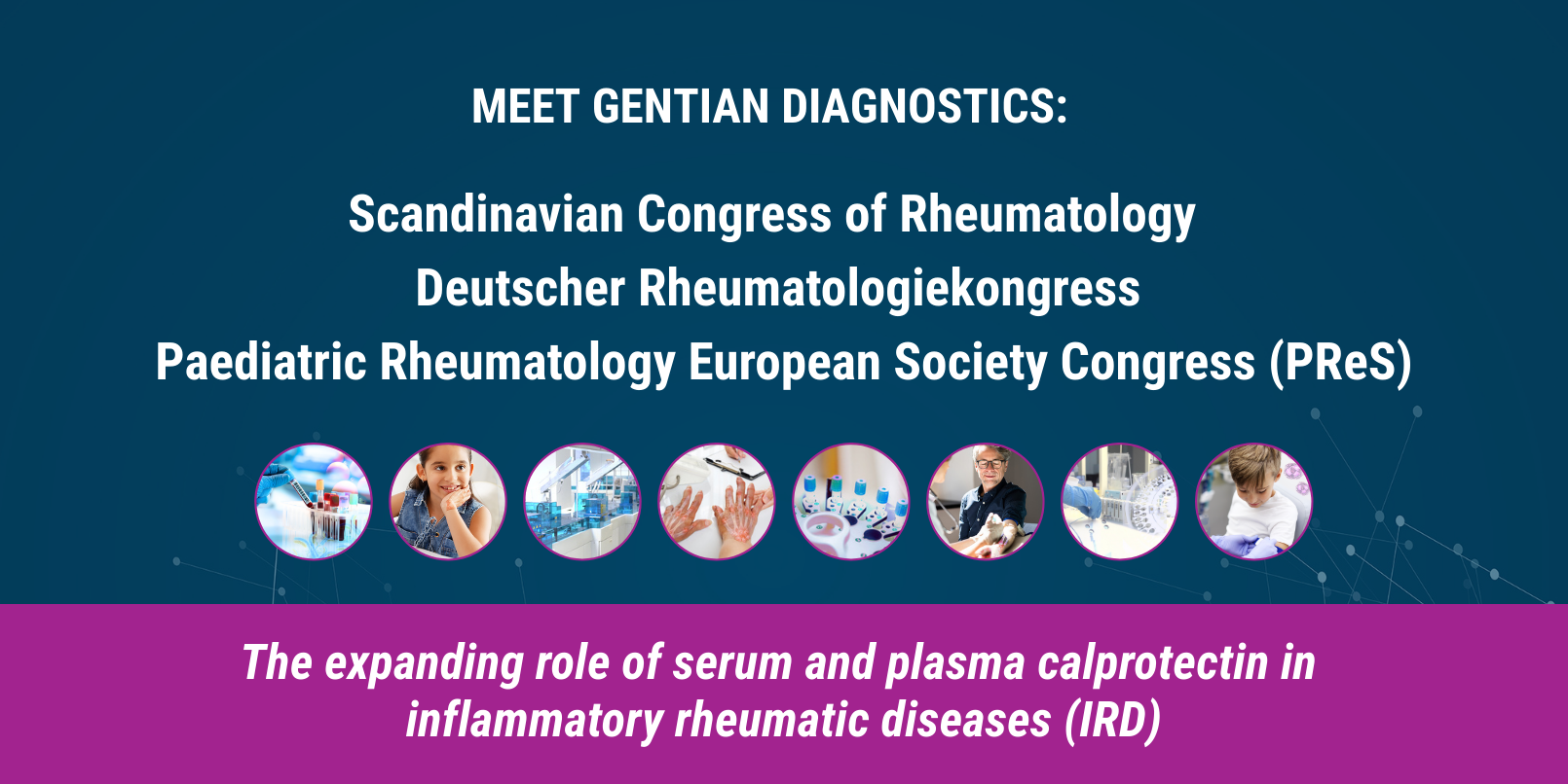 Meet GCAL® in September: Circulating calprotectin for routine rheumatology