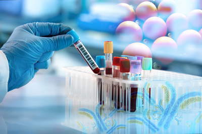 Blood test. Avian antibodies for less interference