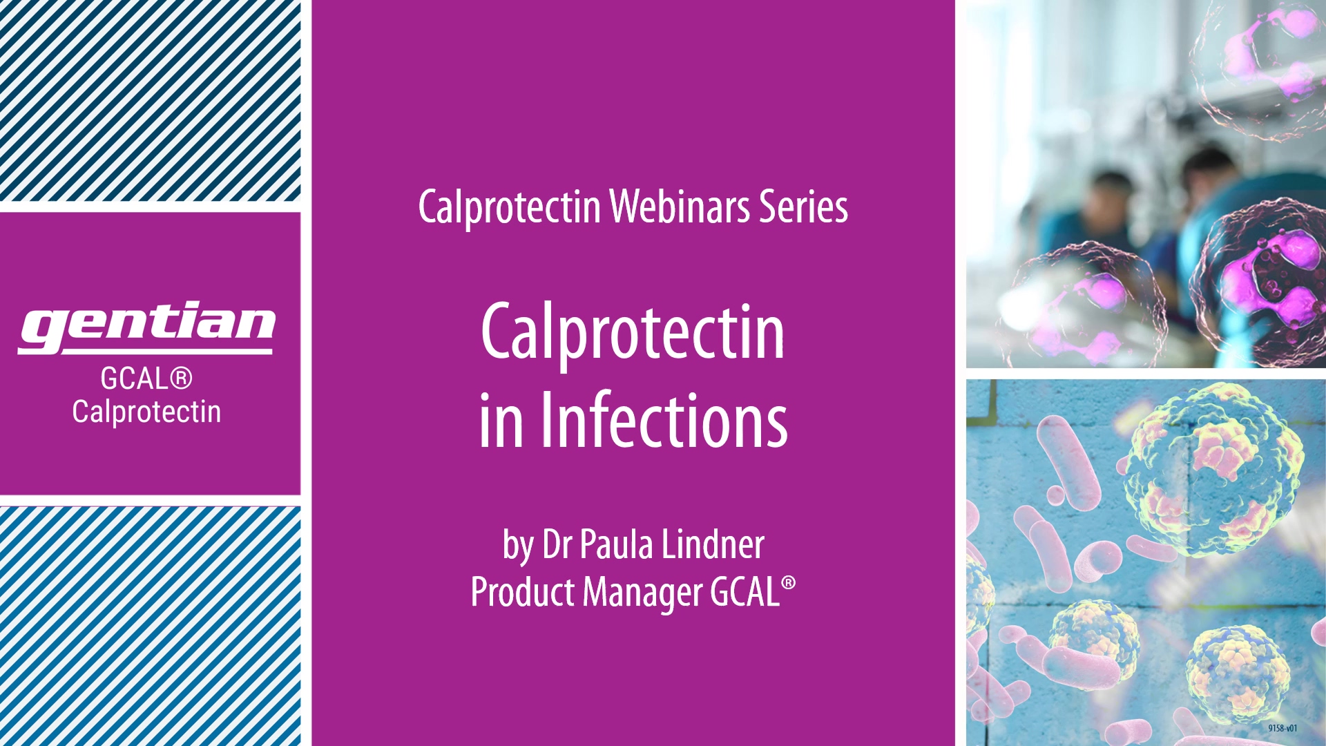 GCAL webinar Infection_