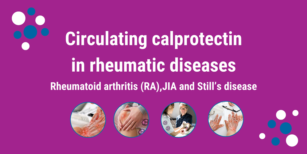 Circulating calprotectin in rheumatic diseases