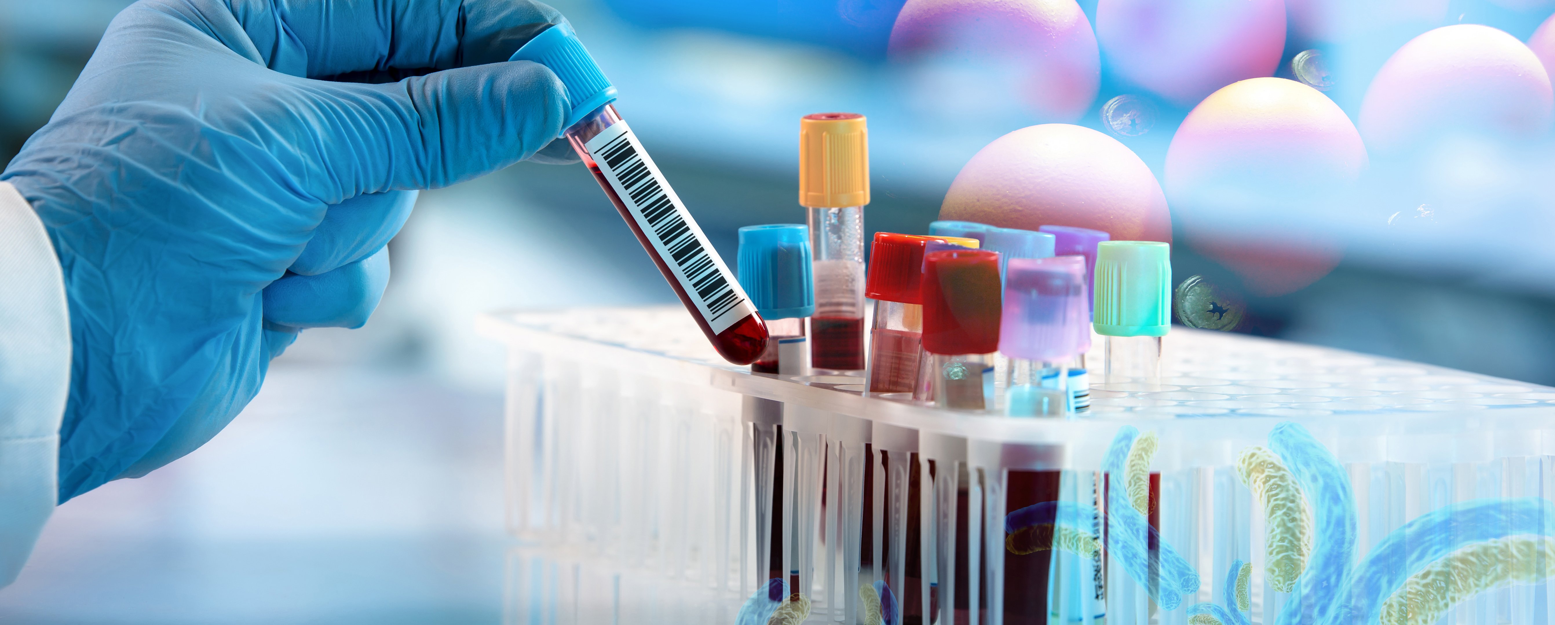 avian antibodies - particle enhanced turbidimetric immunoassays